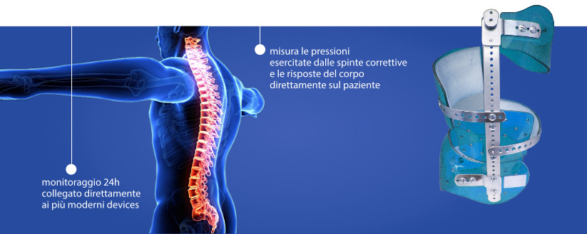 monitoraggio corsetti su misura